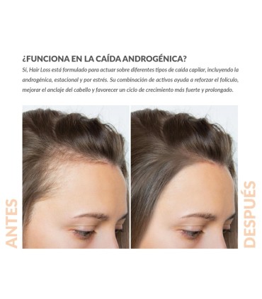 Loción anticaída k-trichology Kukit